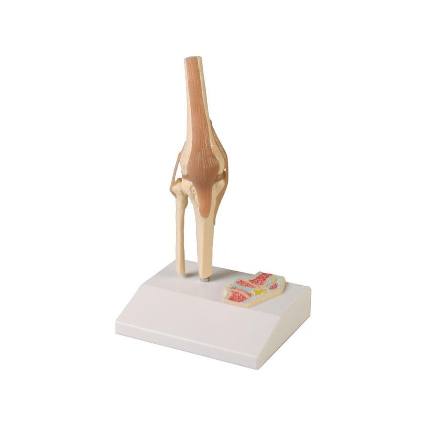 Articulación de rodilla en miniatura con sección transversal