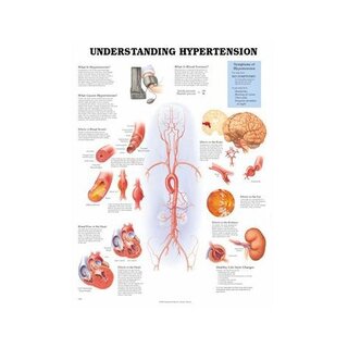 Póster laminado "Entendiendo la presión arterial alta" (51 x 66 cm)