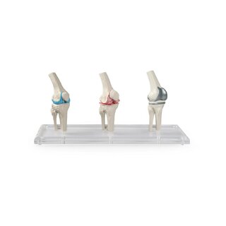 Modelo de implante de rodilla