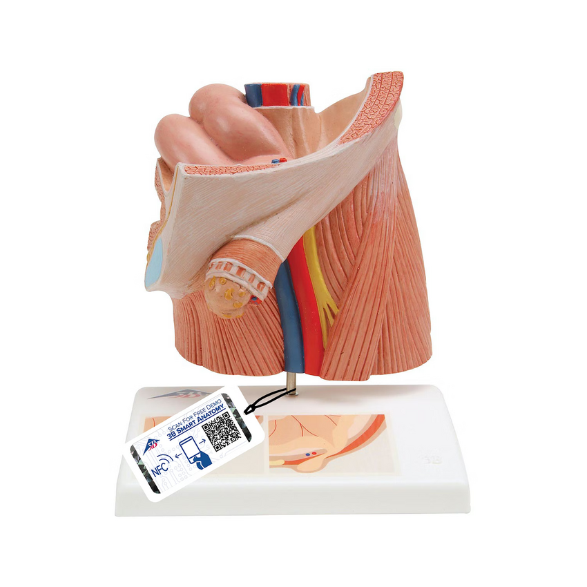 Modelo urológico de hernia inguinal