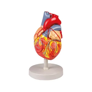 Corazón con bypass, 2x tamaño natural, 4 partes