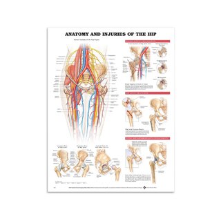 Póster - Anatomía y lesiones de la articulación de la cadera en inglés