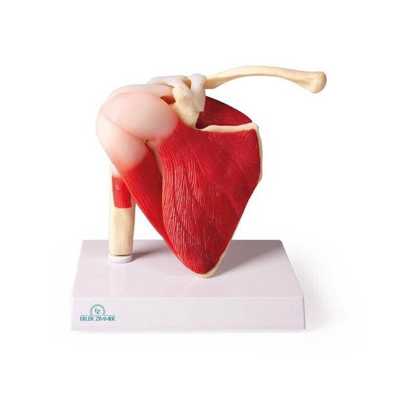 Modelo de hombro con músculos y ligamentos.