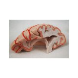 Cerebro de 8 partes con arterias en la cabeza dividida