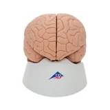 Fundición clásica del cerebro real