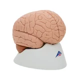 Fundición clásica del cerebro real