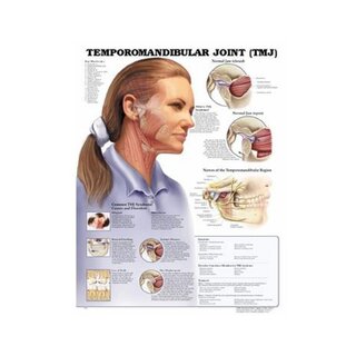 Trastorno de la articulación temporomandibular (ATM) laminado en inglés