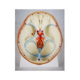 Cerebro de 8 partes con arterias en la cabeza dividida
