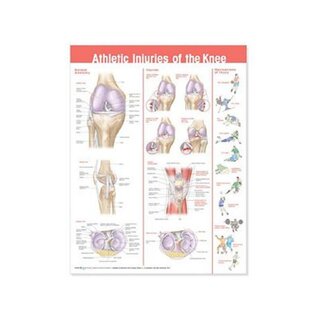 Póster laminado sobre lesiones de rodilla tras la práctica deportiva.
