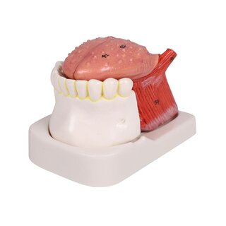 Modelo de lengua y dientes, tamaño natural, 4 partes