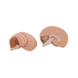 Fundición clásica del cerebro real