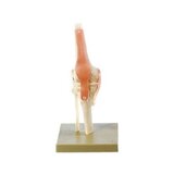 Articulación funcional de la rodilla