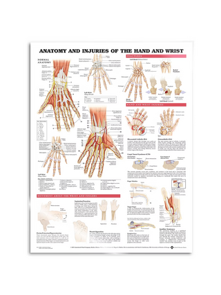 Póster - Anatomía y patología de la mano y la muñeca
