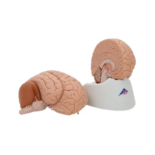 Fundición clásica del cerebro real