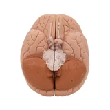 Fundición clásica del cerebro real