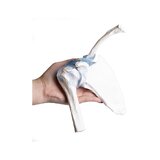 Articulación del hombro con ligamentos con soporte